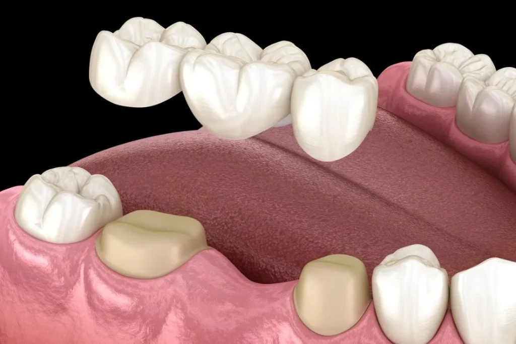 Dentist in San Antonio TX