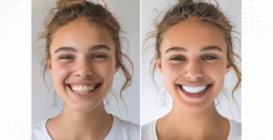 Turn back the clock on your smile