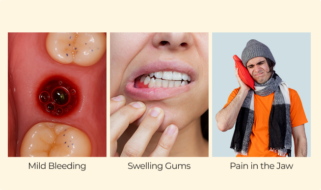 Stage 1 First 24 to 48 Hours – Start of Healing