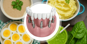 Dental implants with soft foods like eggs, soup, and mashed potatoes.
