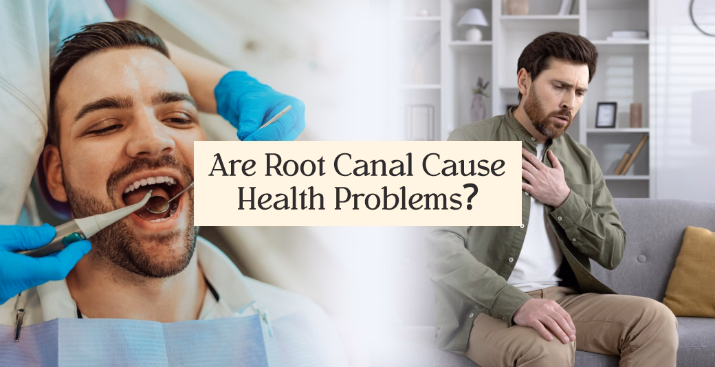Can Root Canals Cause Health Problems? Know the Myth & Fact