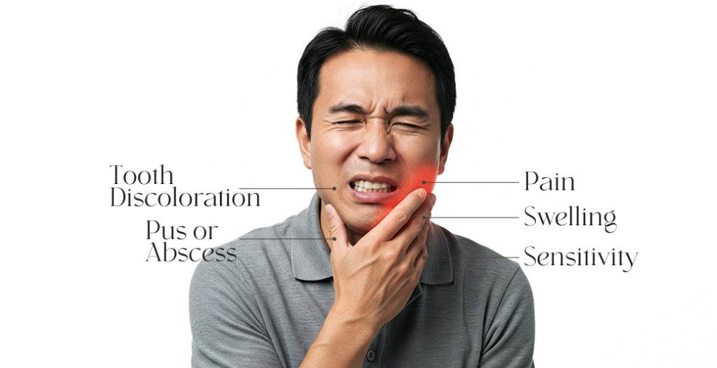 Signs of dental infection: pain, swelling, sensitivity, discoloration, abscess