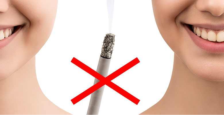 Healthy white teeth vs. yellow teeth with a crossed-out cigarette in the middle.