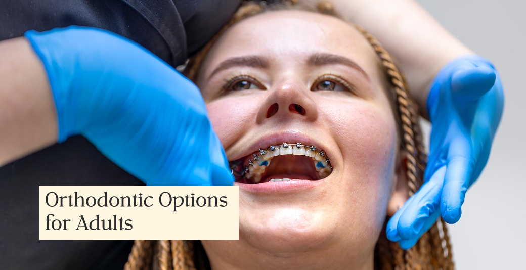 Adult Orthodontic Treatment: From Braces to Surgery, What Works Best