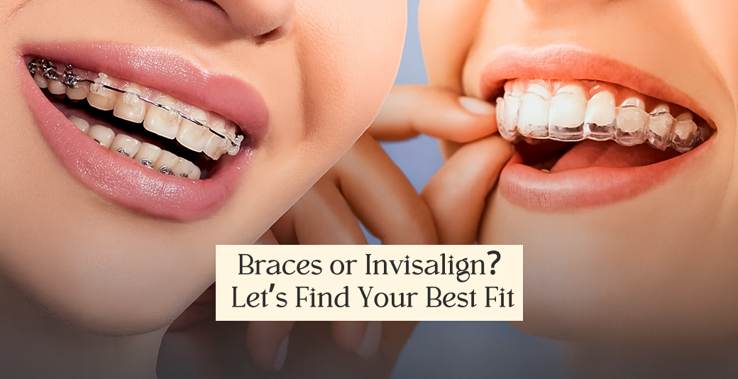 What Is Better Invisalign or Braces: Honest Comparison by Experts