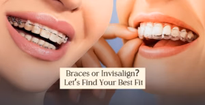 Close-up of two smiles—one with metal braces, one with clear aligners.