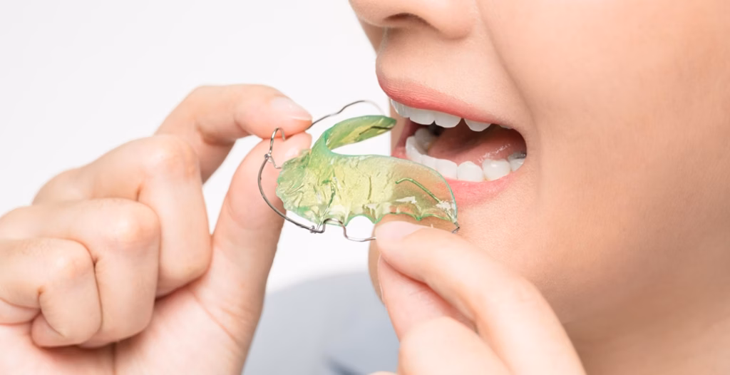 Person holding a green Hawley retainer near their mouth, preparing to insert it over aligned teeth.
