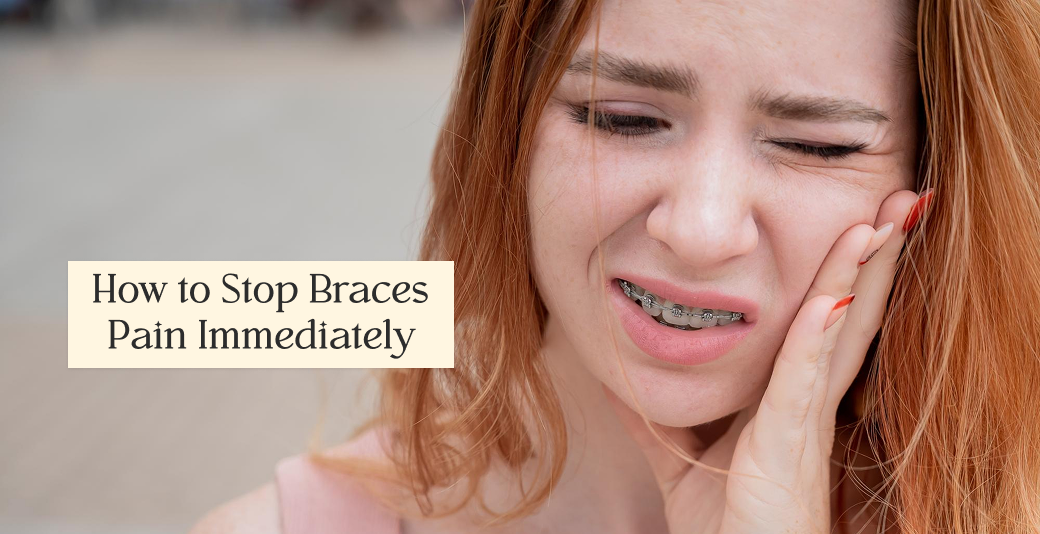 How to Stop Braces Pain Immediately