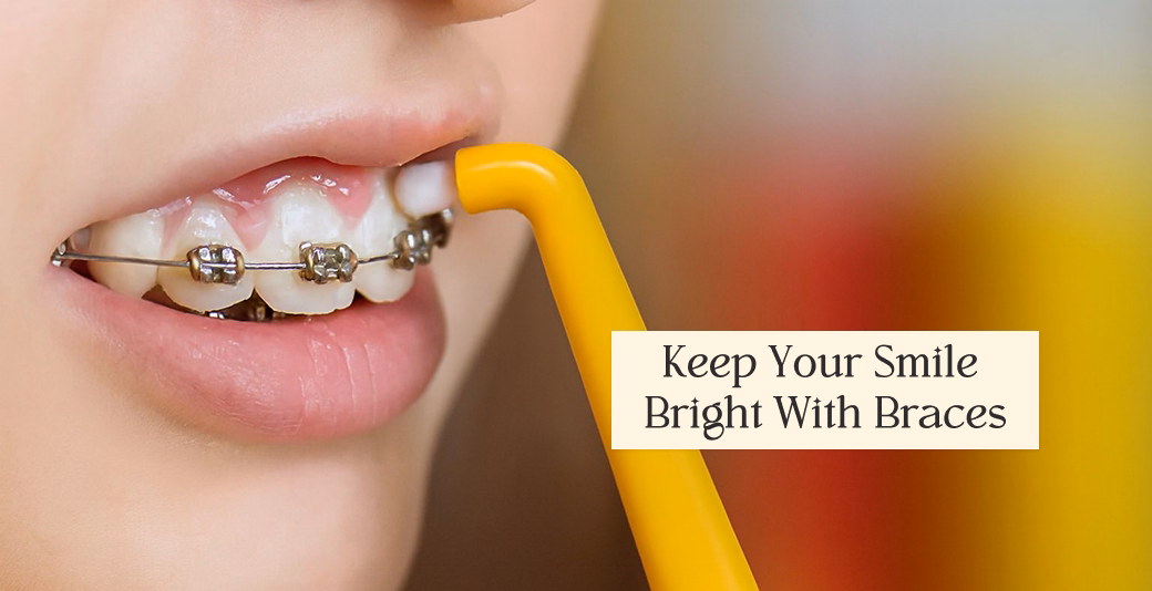 Person cleaning braces with yellow interdental brush, highlighting proper oral hygiene and dental care.