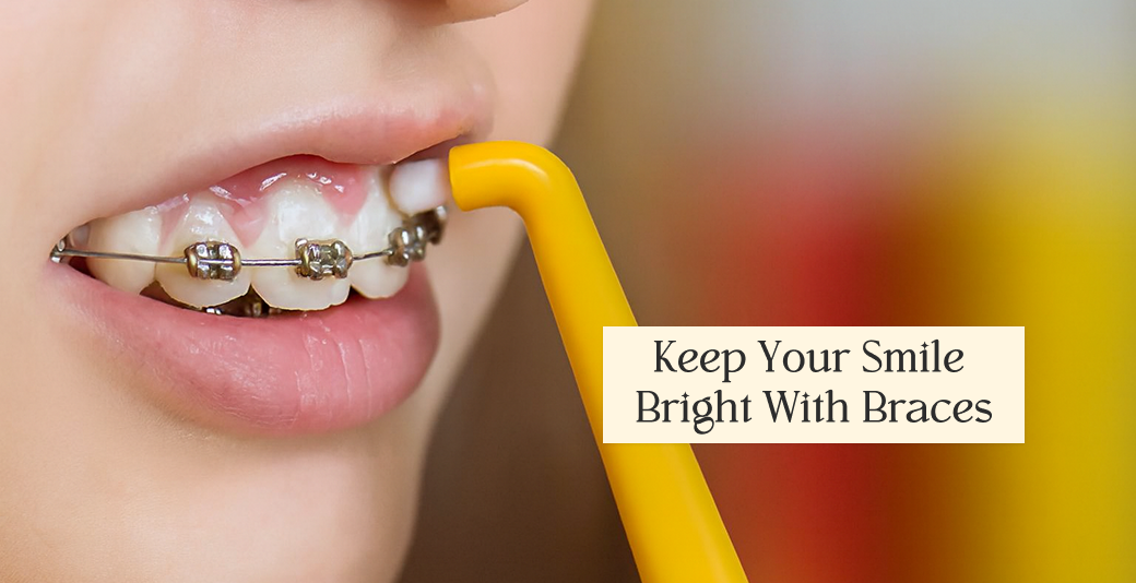 How to Whiten Teeth With Braces Safely