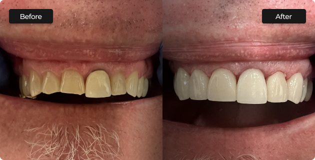 Frame 1618873559 (3)