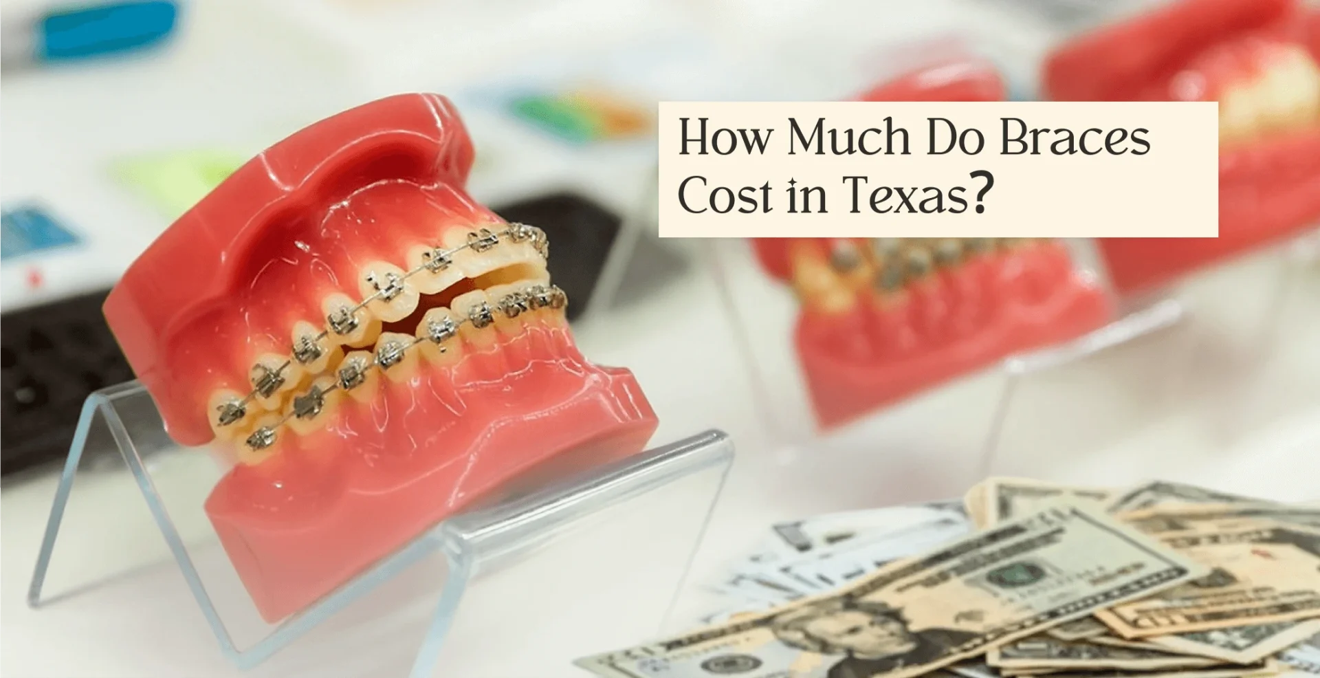 How Much do Braces Cost in Texas With & Without Insurance