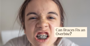 Close-up of teen with braces scrunching face, text overlay asks if braces fix an overbite