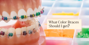 Dental model with colorful braces bands and text asking “What color braces should I get?