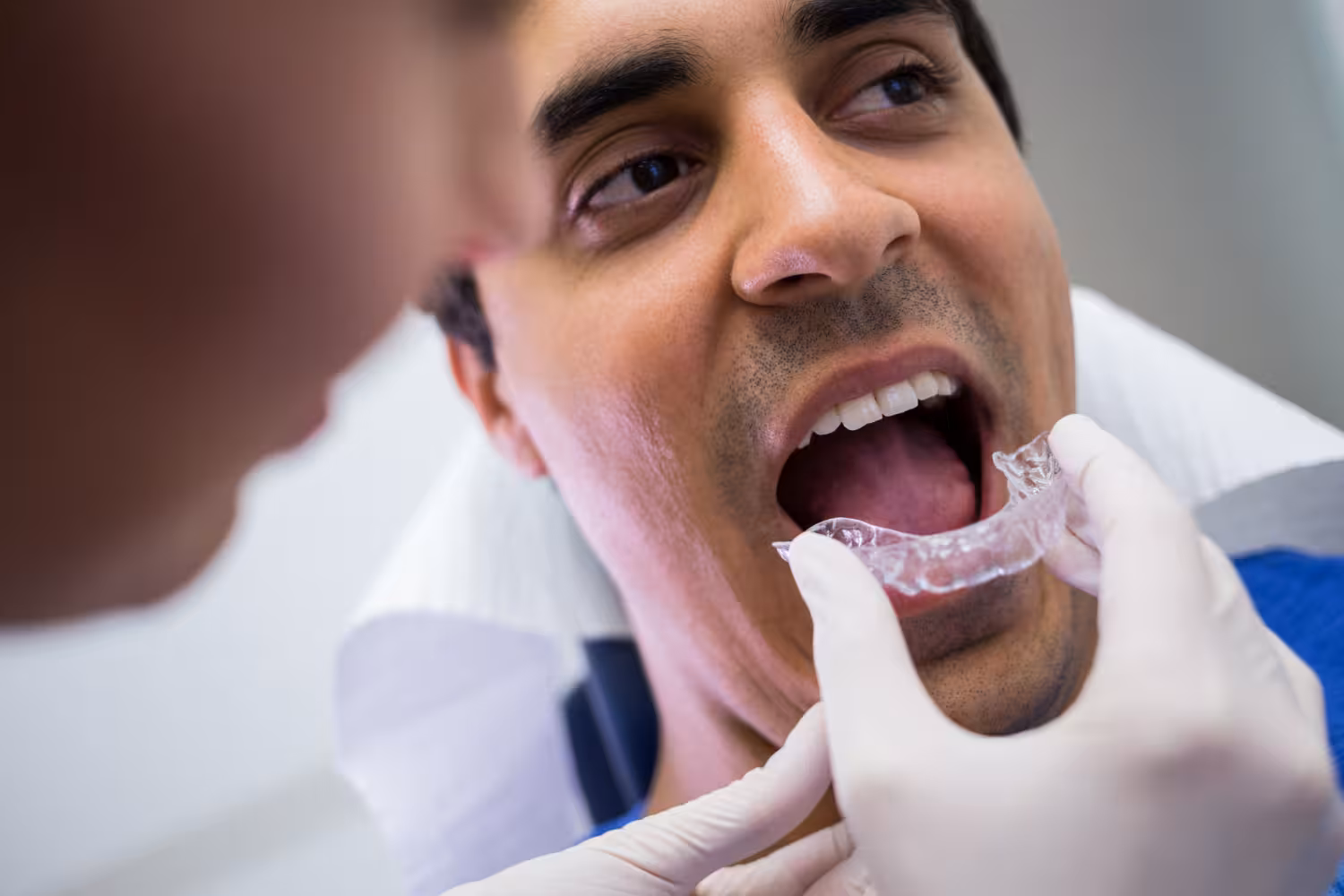 clear aligners in San Antonio for discreet teeth straightening and improved smile