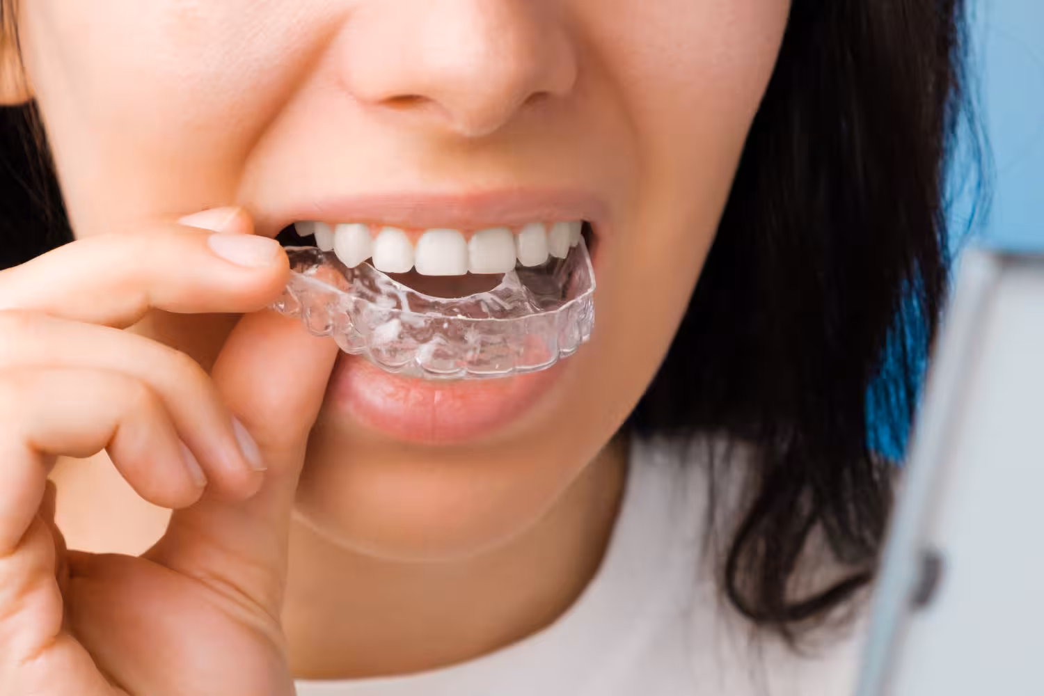 custom night guards in San Antonio to protect teeth from grinding and improve comfort