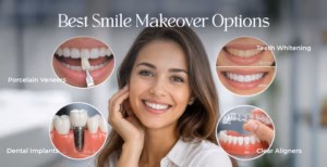 Smiling woman surrounded by dental treatment visuals showing veneers, implants, whitening, and clear aligners.