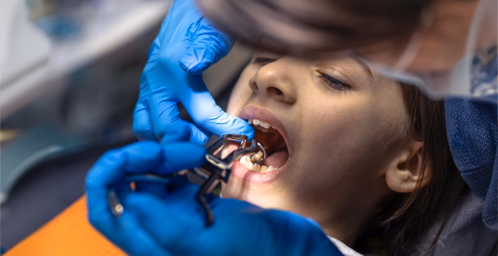 A dentist in blue gloves uses dental pliers to perform a procedure on a child's lower teeth.